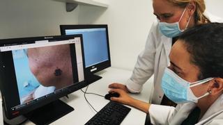 Vall d'Hebron abre la puerta a que un melanoma pase de ser agresivo a tener un buen pronóstico