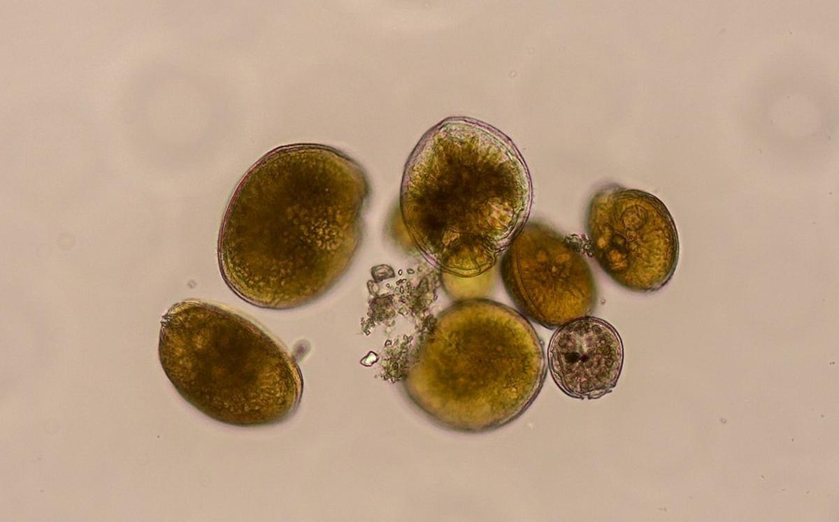 Gambierdiscus australes en microscopi òptic invertit