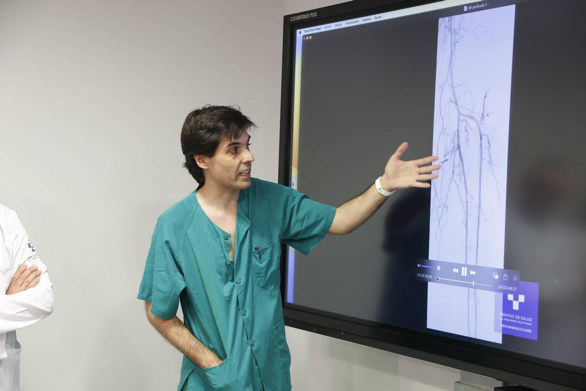 El servicio de Angiología y Cirugía Vascular ya ha realizado dos intervenciones con este procedimiento.