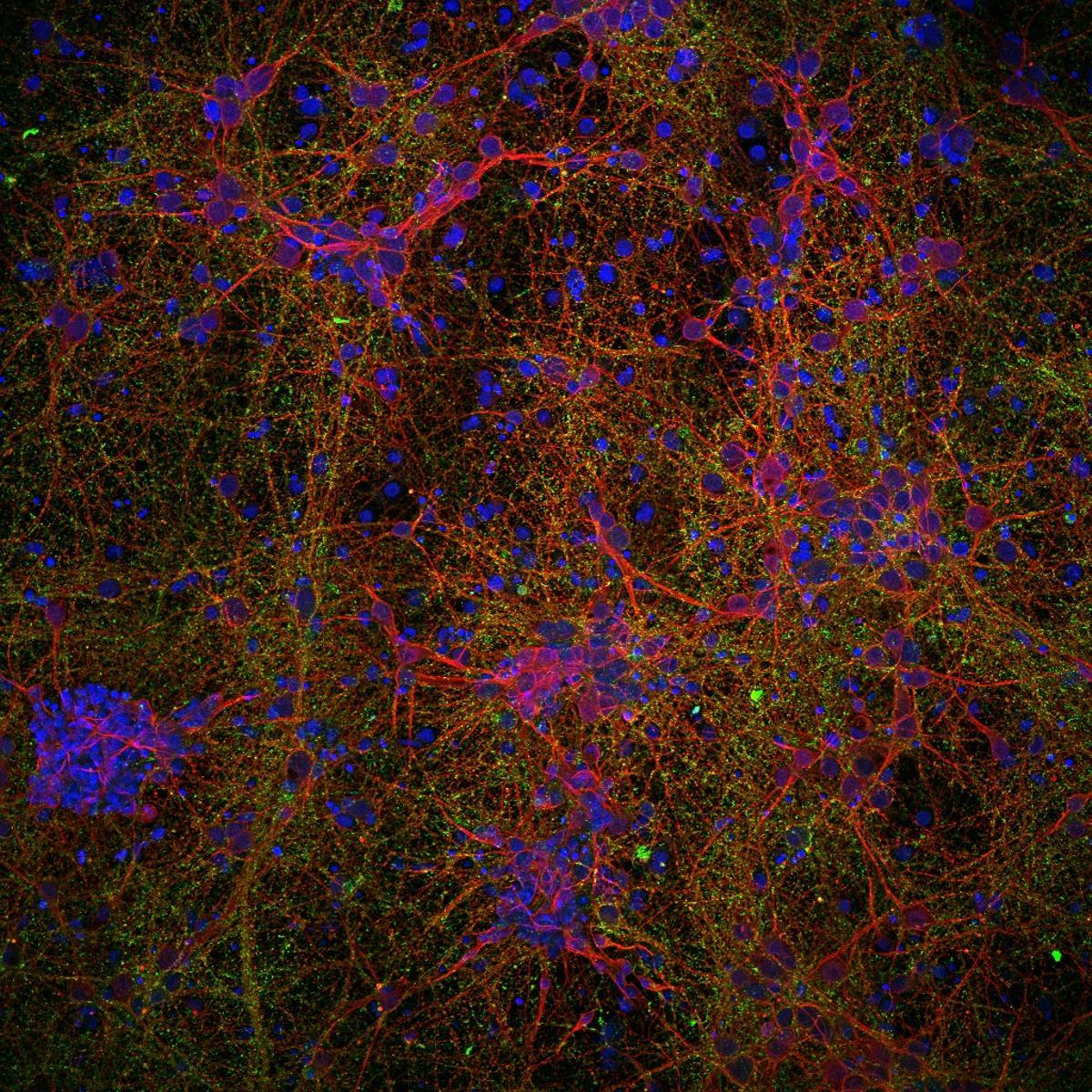 Imagen microscópica de células neurales con nanopartículas de óxido de hierro.