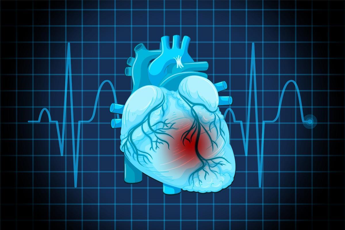 La insuficiencia cardiaca se produce porque el corazón no es capaz de bombear suficiente sangre.