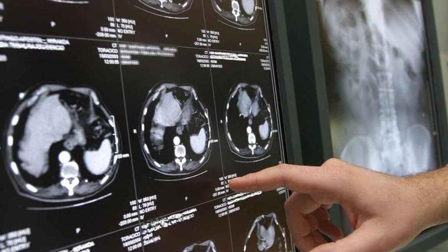 Un profesional examina imágenes de un escáner en un hospital.