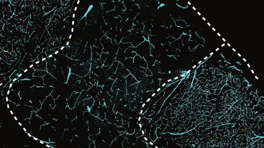 La línea punteada marca el borde del organoide humano trasplantado en la corteza cerebral de la rata.