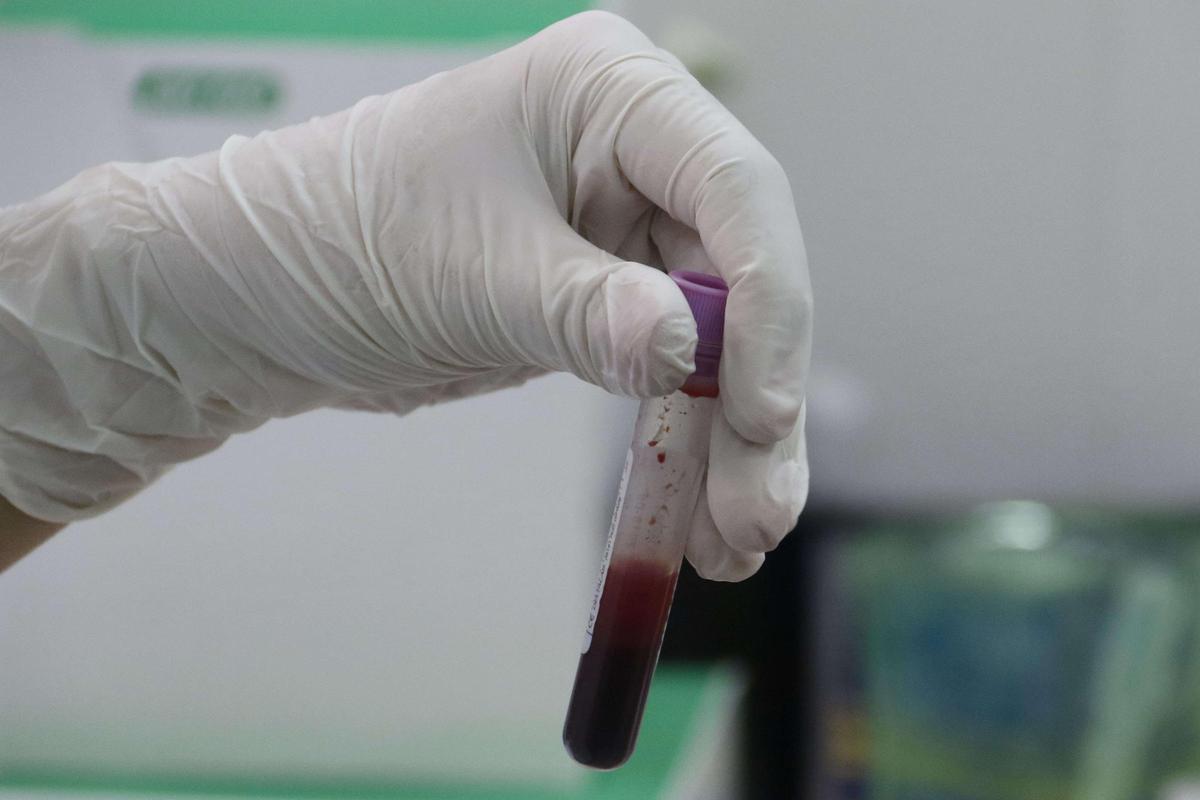 Un sanitario sujeta un tubo con la muestra de sangre de un paciente para ser analizada.