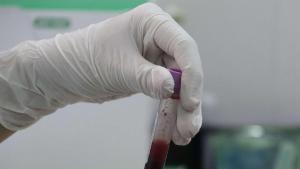 Un sanitario sujeta un tubo con la muestra de sangre de un paciente para ser analizada.