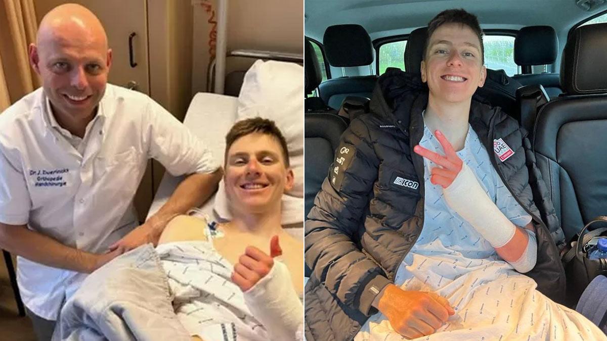 Pogacar ya fue intervenido