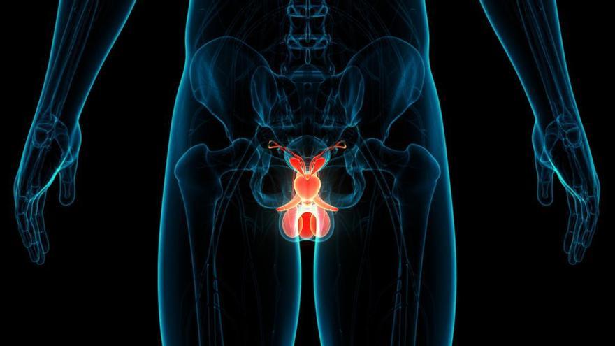 Descubren un mecanismo para atacar a los cánceres de próstata resistentes a los tratamientos