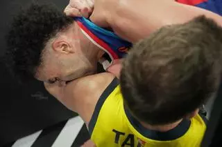 ¿Qué es esto? Una pela en un partido de la Euroliga, termina en con mordiscos...
