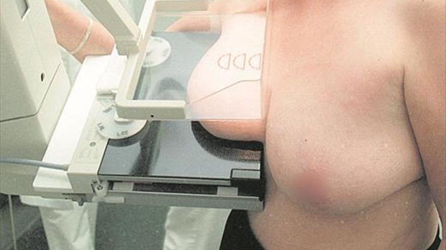 Sanidad deniega el mamógrafo en Onda porque estaría «infrautilizado»