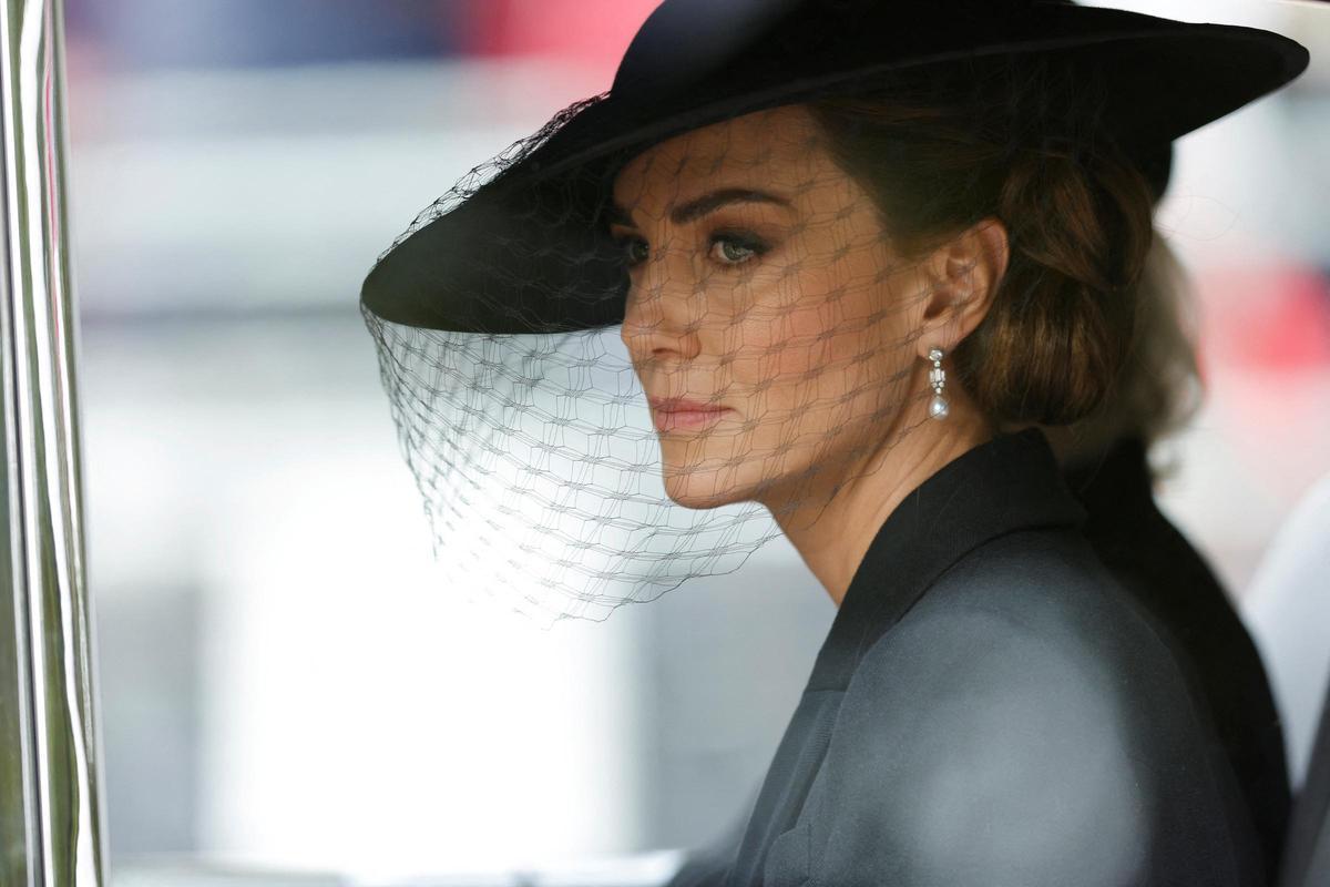 ÚLTIMA HORA | Kate Middleton en coma inducido e intubada tras su operación