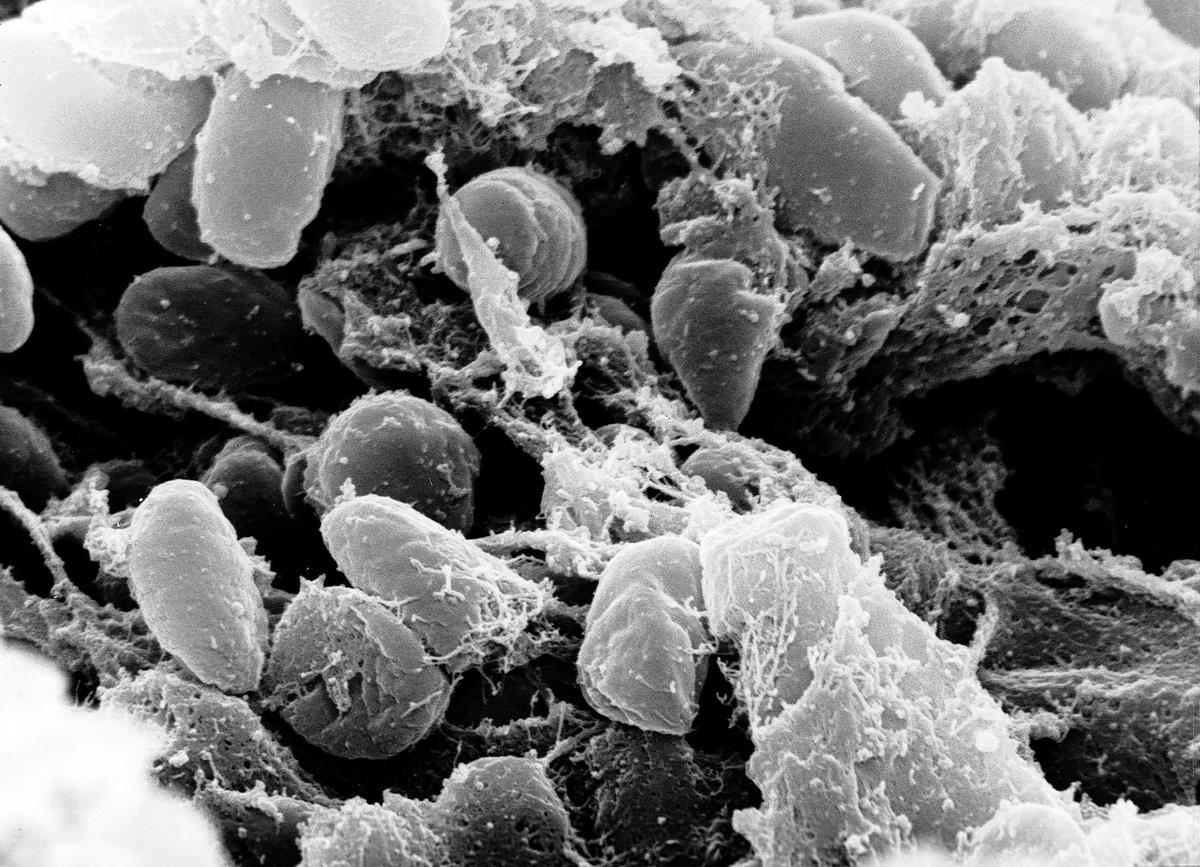 La peste está causada por la bacteria Yersinia pestis y puede transmitirse a través de pulgas infectadas o, en su forma neumónica, de persona a persona mediante gotículas respiratorias