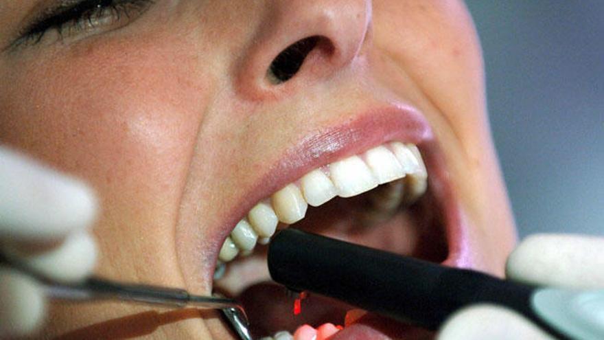 Principales preocupaciones por un implante dental
