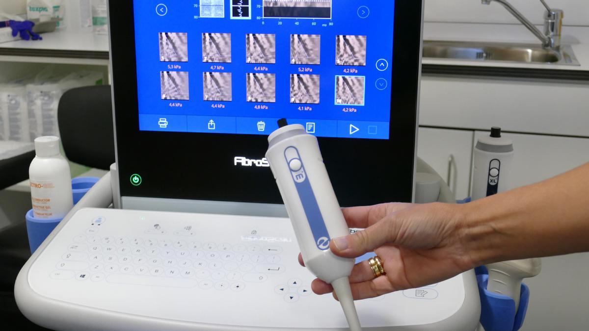 El FibroScan permite evaluar de forma no invasiva la rigidez y la grasa hepática.