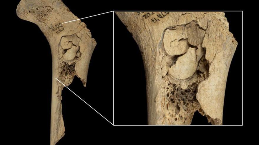 Despellejados y devorados: nuevo caso de canibalismo en Atapuerca