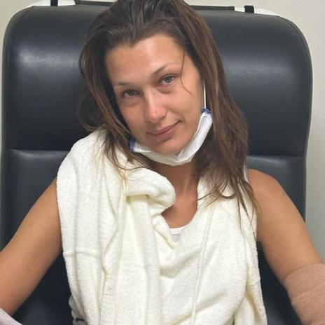 Bella Hadid habla abiertamente de su ansiedad médica mientras lucha contra su enfermedad