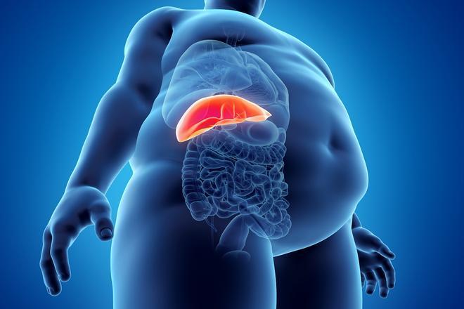 Una investigación asocia la microbiota intestinal con casos más graves de hígado graso