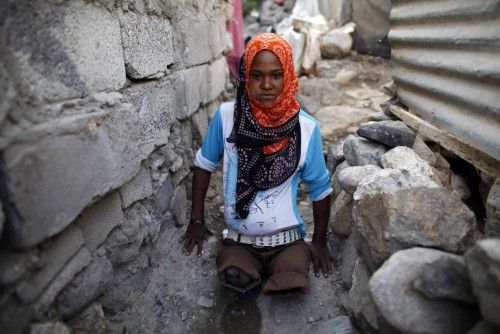 Ahlam Salem, de 15 años de edad, se desplaza por un barrio pobre en la ciudad de Yemen