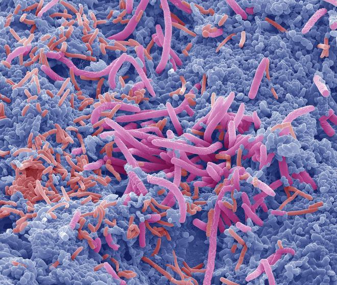 Un microorganismo intestinal podría estar relacionado con niveles más bajos de glucosa en sangre