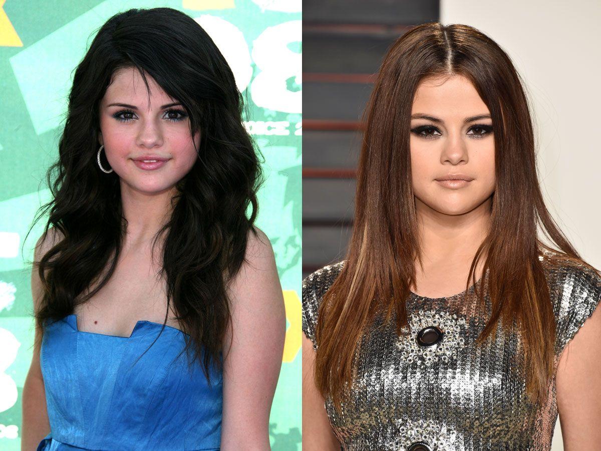 El antes y el después: Selena Gómez