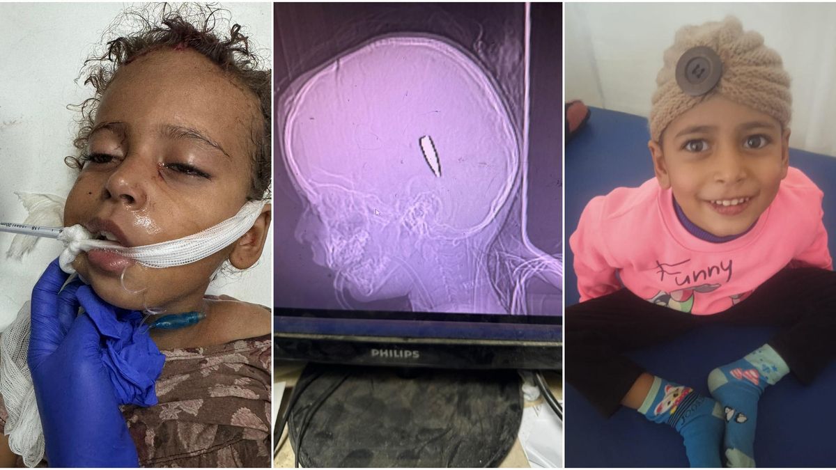 Mira Al-Darini, una nena de quatre anys salvada després d'un xut a Gaza.