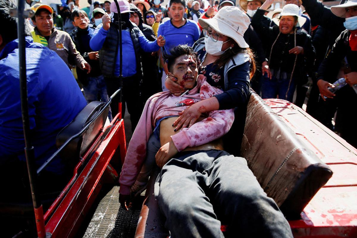 Manifestantes asisten a un hombre herido durante un enfrentamiento con las fuerzas de seguridad en Perú.