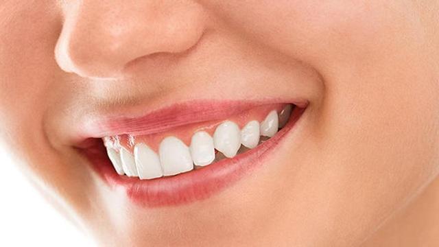 Tipos de implantes dentales y precios