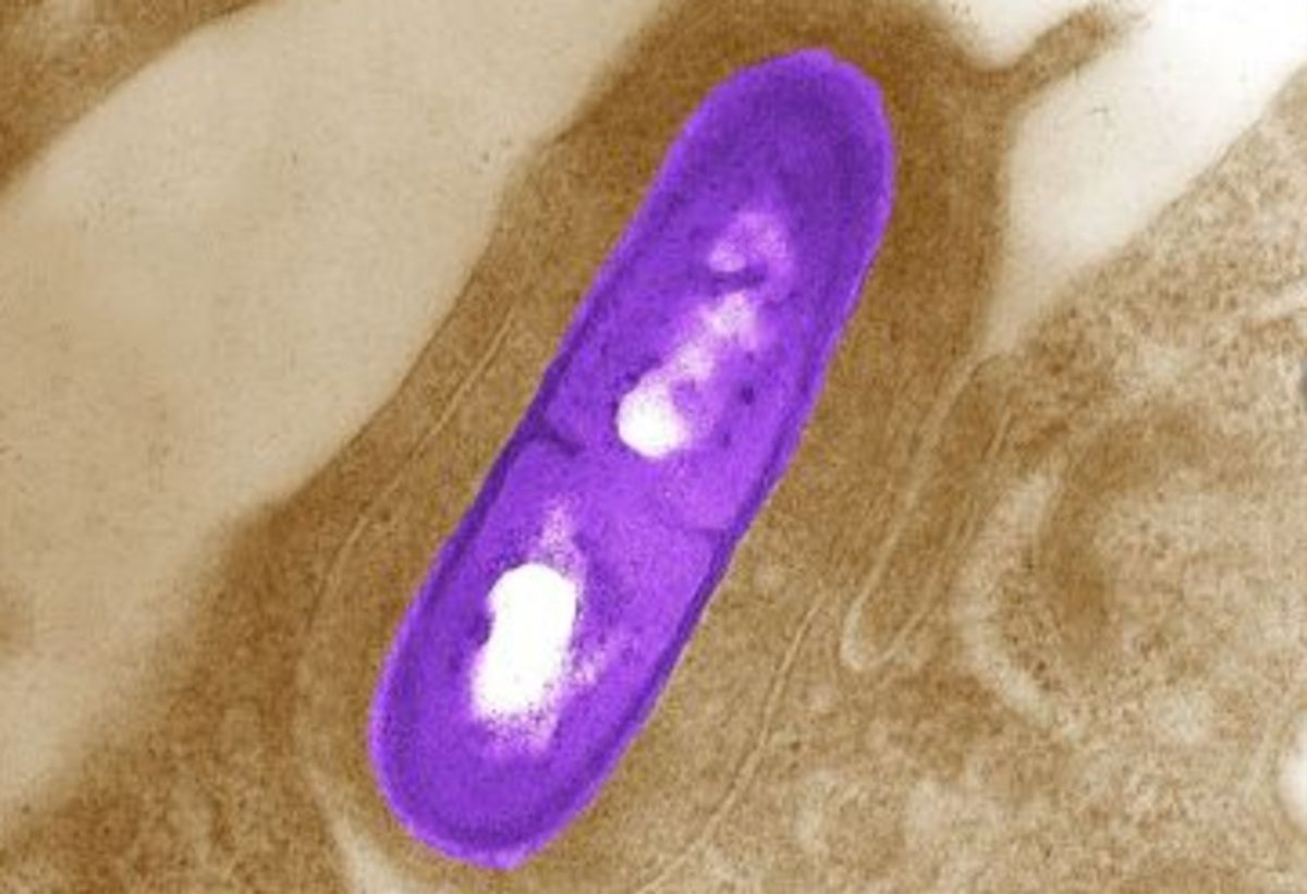 listeriosisi bacteria listeria monocytogenes