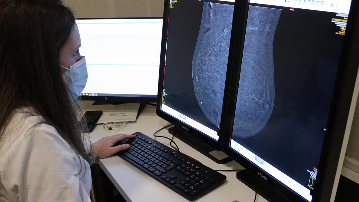 Imagen de mamografía con contraste.