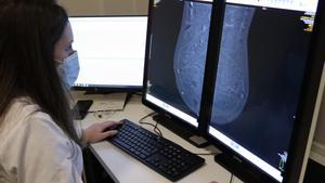 Archivo - Radióloga observa imagen de mamografía con contraste.