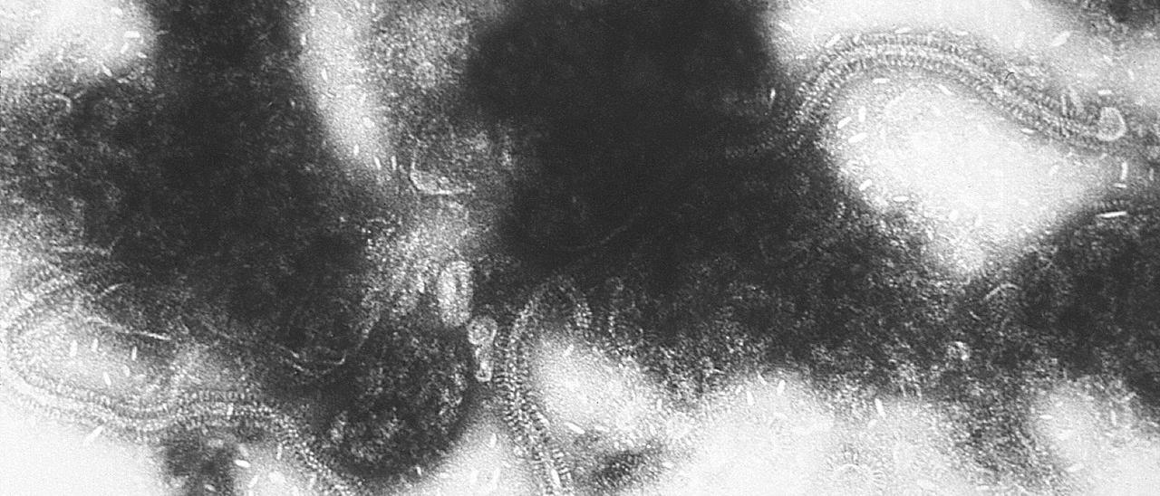 Este es el temido VRS, virus respiratorio sincitial, que causa las peligrosas bronquiolitis