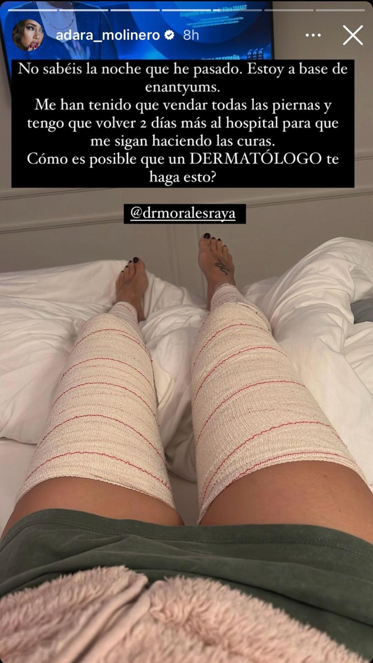 Adara Molinero denuncia lo ocurrido en redes sociales.