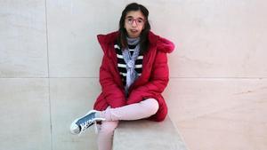 Zaira Sardina, adolescente con el síndrome de Treacher Collins.