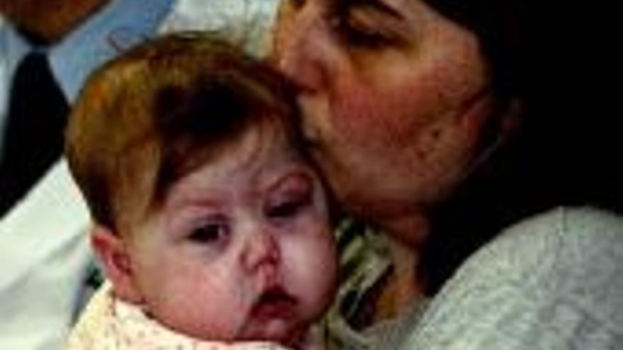 Una niña italiana de seis meses resiste el trasplante de ocho órganos