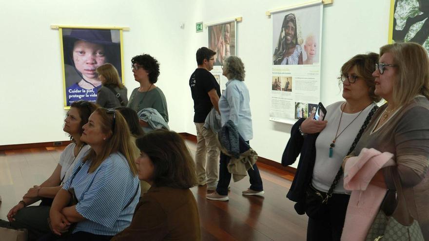 Beyond Suncare acerca la realidad albina a Vigo con una muestra fotográfica en Afundación