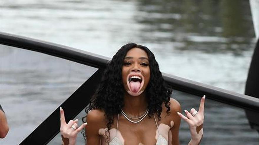 Winnie Harlow festeja sus 24 años en Miami