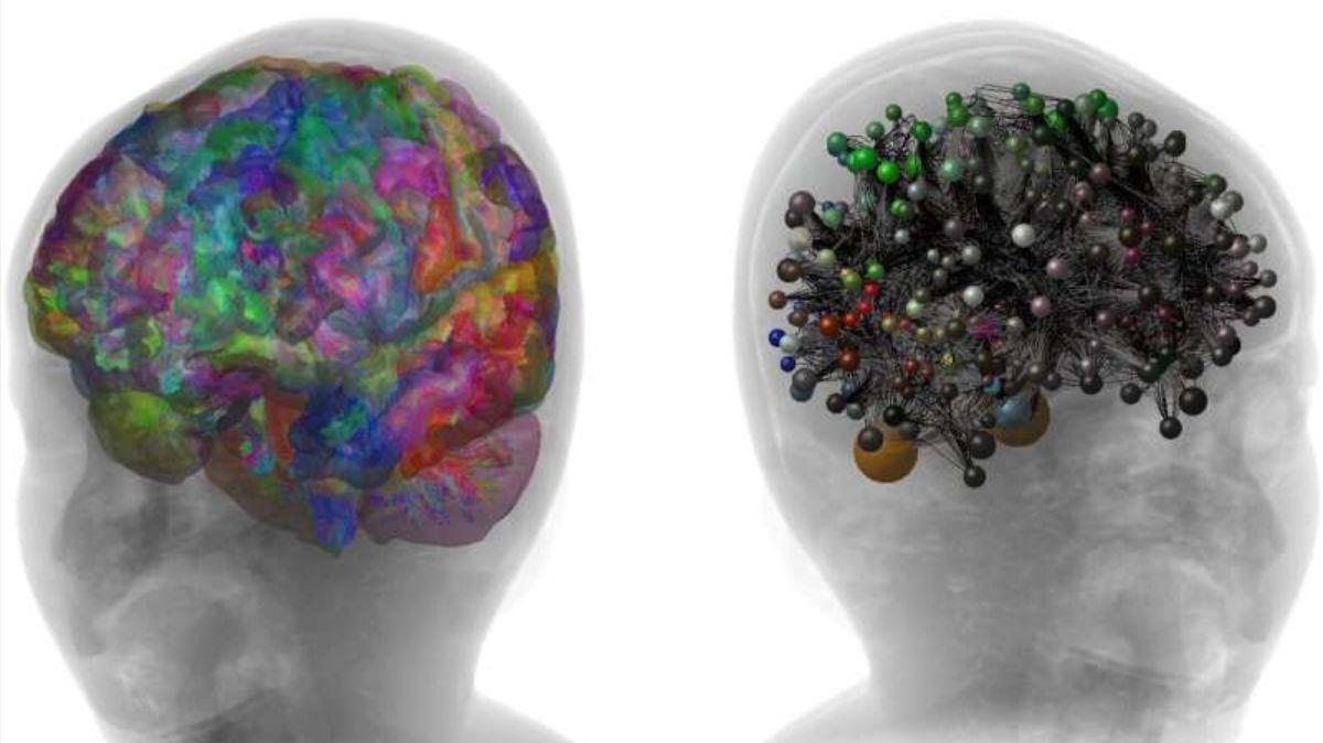 Tractografía del cerebro del niño voluntario y de su gemelo digital.