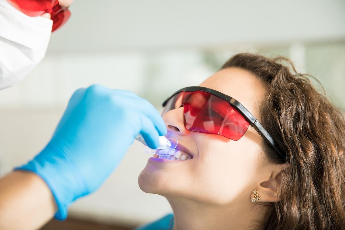 El blanqueamiento dental es un tratamiento odontológico que debe ser supervisado por un profesional.