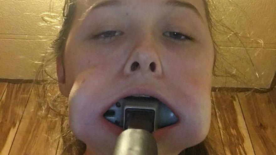 Una joven que se metió un martillo en la boca triunfa en Twitter