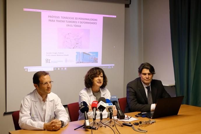 Las Palmas de Gran Canaria . Presentación de resultados del sistema de prótesis torácicas 3D.  | 05/02/2020 | Fotógrafo: José Carlos Guerra