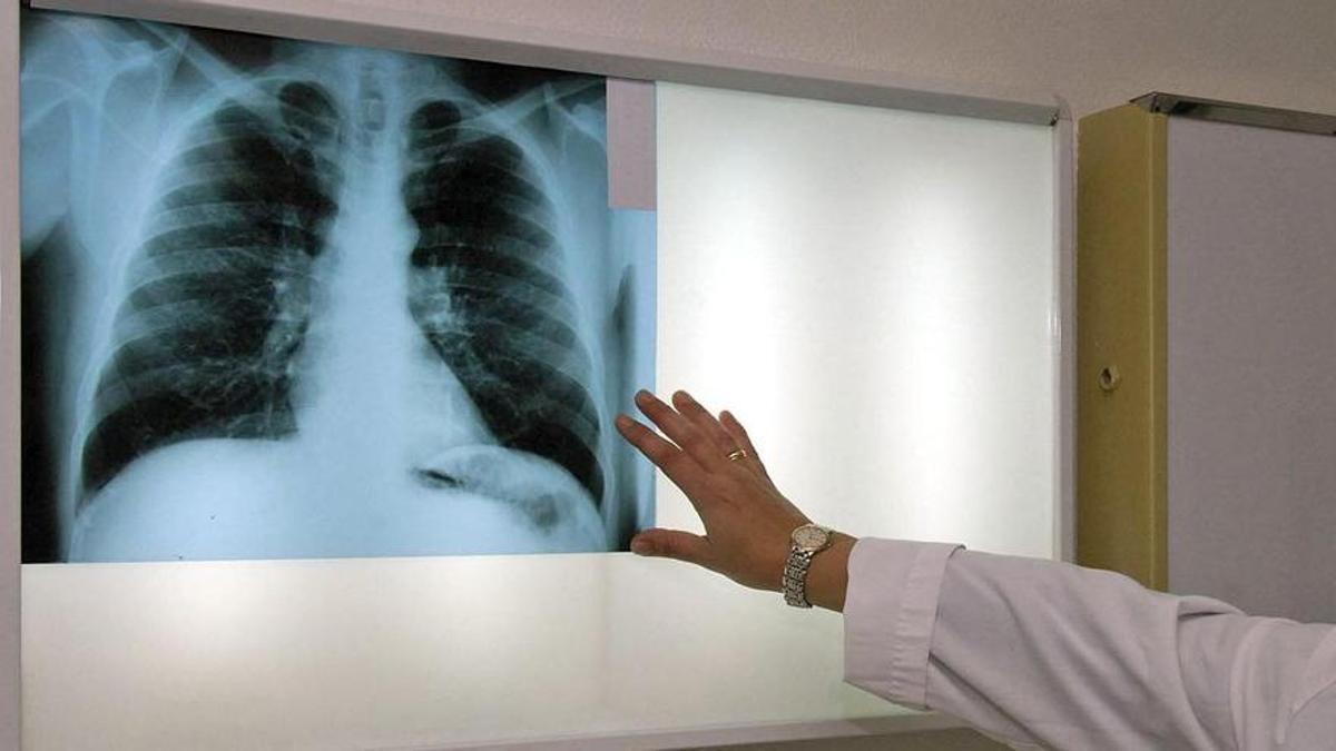 Una doctora analiza la radiografía de un paciente.