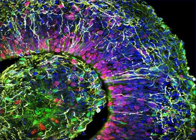 La consciencia ya se podría crear en laboratorio