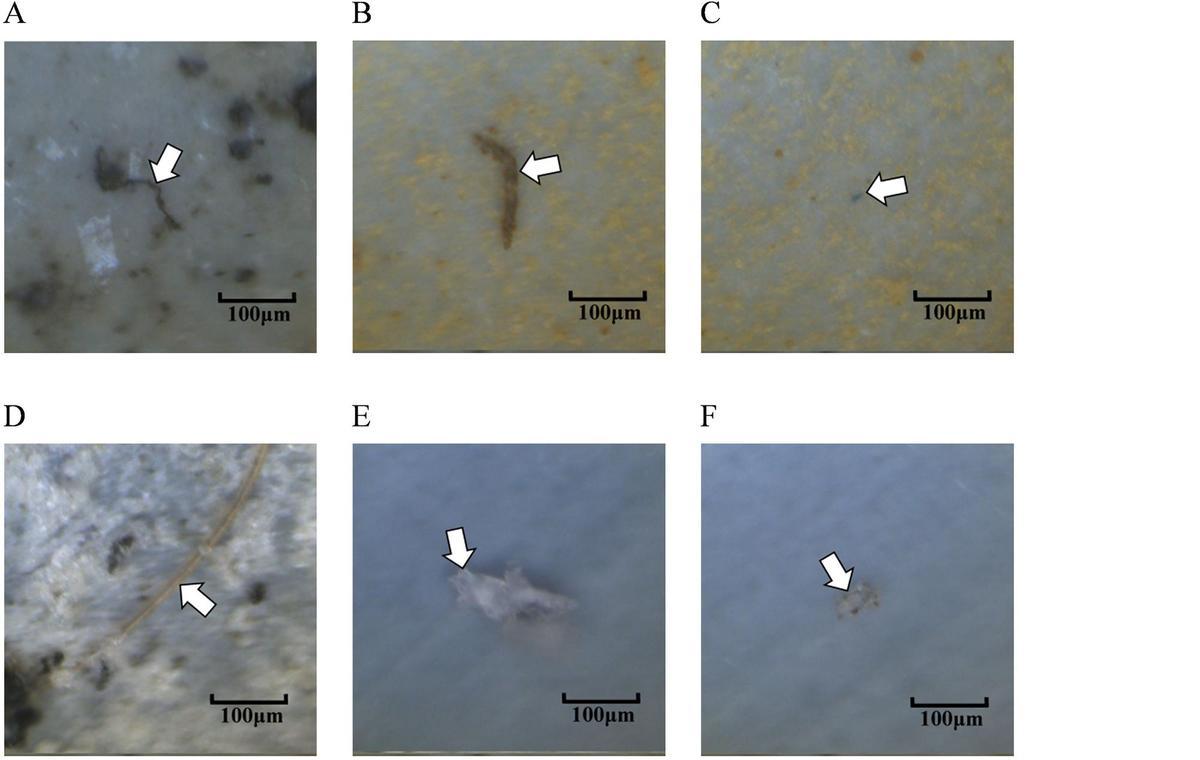 Fragmenos de plástico hallados en los pulmones