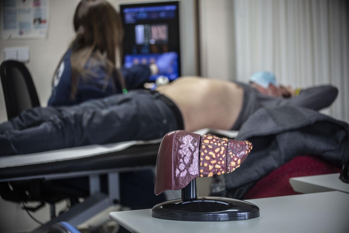 Cribado de hígado en el Hospital de Alicante con la prueba denominada elastografía