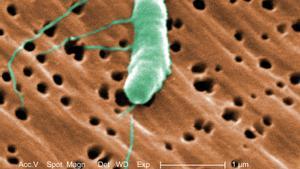 La bacteria carnívora Vibrio Vulnificus