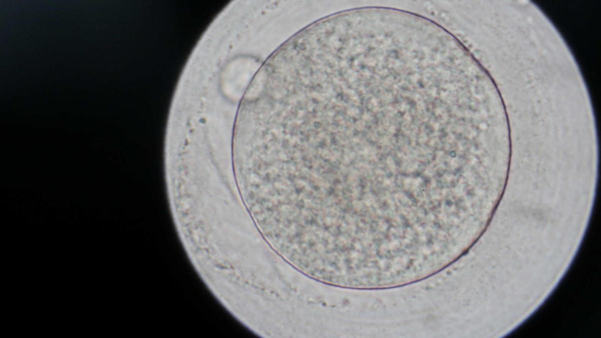 Diez niños de un donante de esperma portador de un gen cancerígeno nacieron en España