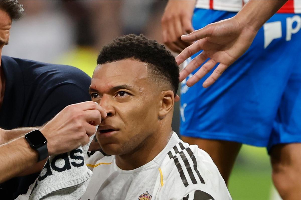 Kylian Mbappé, tras el codazo de Vitor Reis.