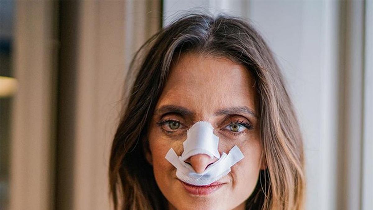 Macarena Gómez, con vendajes típicos de la rinoplastia