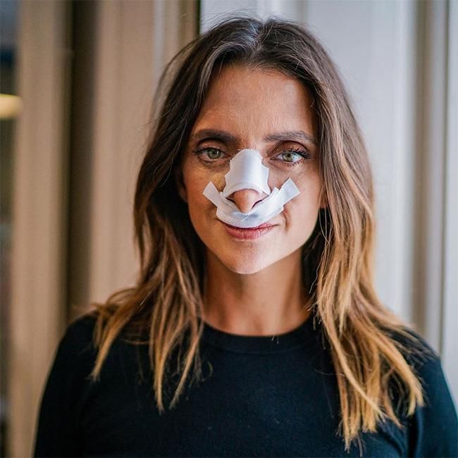 Macarena Gómez, con vendajes típicos de la rinoplastia