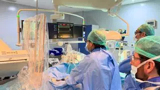 El Hospital San Juan de Dios aplica por primera vez la novedosa técnica PulseSelect para tratar un tipo de arritmia