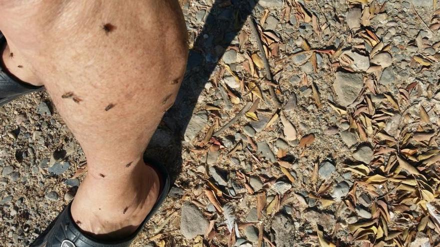Una vecina muestra los estragos que han causado las moscas en su cuerpo.